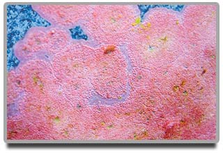 Image of pink algae on pool wall
