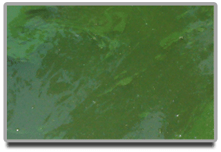 Planktonic algae sample taken from swimming pool
